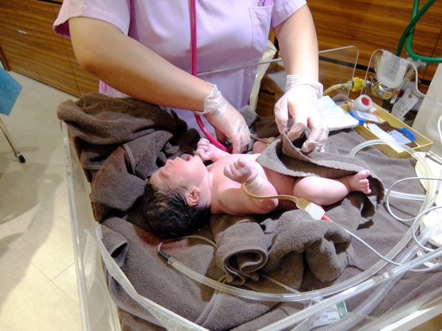 出産したばかりの患者様の赤ちゃん